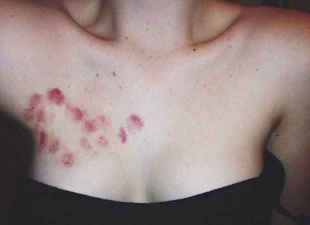 Passionate sexual couples are familiar with the phenomenon that visually indicates sexual contact.